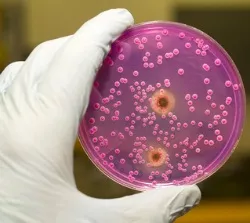 Bakterien-Nachweis